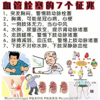 孕期血栓高(孕期血栓高会有什么后果?) 第1张 孕期血栓高(孕期血栓高会有什么后果?) 第1张