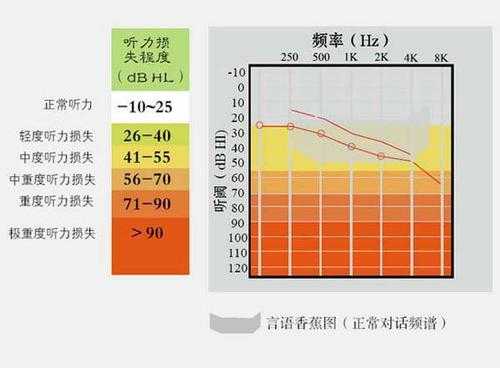 胎儿听力受损的原因(胎儿听力受损的原因) 第1张 胎儿听力受损的原因(胎儿听力受损的原因) 第1张