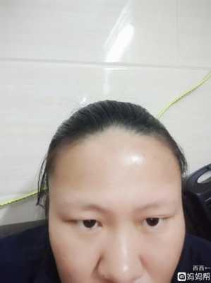 孕期后变黑(孕期脸变黑了是怎么回事) 第2张 孕期后变黑(孕期脸变黑了是怎么回事) 第2张
