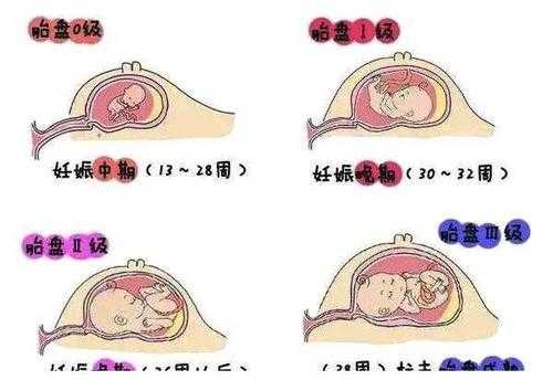 孕多少周胎盘才能达到2级?32周胎盘2级正常吗,孕32周胎儿发育情况及各项指标 第1张 孕多少周胎盘才能达到2级?32周胎盘2级正常吗,孕32周胎儿发育情况及各项指标 第1张