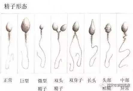 胎儿畸形与精子有关吗(胎儿畸形与精子有关吗) 第2张 胎儿畸形与精子有关吗(胎儿畸形与精子有关吗) 第2张