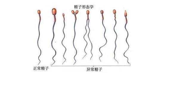 胎儿畸形与精子有关吗(胎儿畸形与精子有关吗) 第1张 胎儿畸形与精子有关吗(胎儿畸形与精子有关吗) 第1张