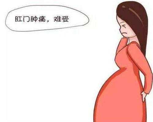 孕妇痔疮对胎儿有影响吗（孕妇痔疮对胎儿有影响吗视频）  第1张