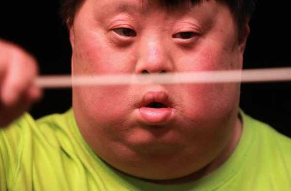 唐氏胎儿有什么表现,唐氏孕期症状 第2张 唐氏胎儿有什么表现,唐氏孕期症状 第2张