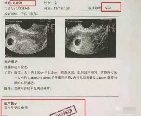 为什么怀孕实际天数跟B超不一样,孕期b超数据对照表 第1张 为什么怀孕实际天数跟B超不一样,孕期b超数据对照表 第1张