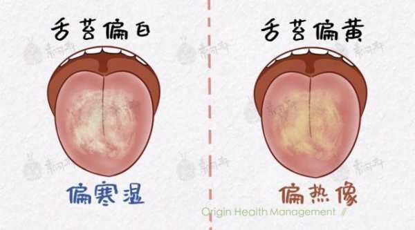 产妇舌苔厚白是怎么办?是不是体内湿气重?吃什么比较好,孕期舌苔厚白是什么原因 第2张 产妇舌苔厚白是怎么办?是不是体内湿气重?吃什么比较好,孕期舌苔厚白是什么原因 第2张