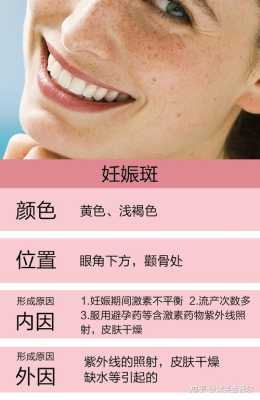 怎样消除脸上的妊娠斑,防止妊娠斑 第3张 怎样消除脸上的妊娠斑,防止妊娠斑 第3张