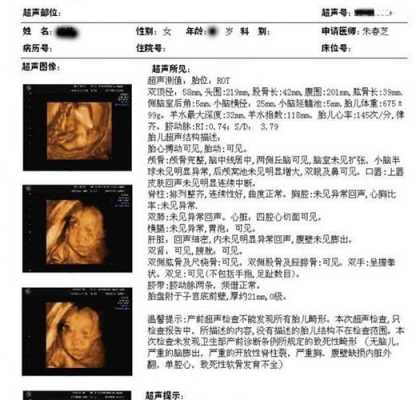 如何看四维单上的数据,四维彩超如何看胎儿性别 第3张 如何看四维单上的数据,四维彩超如何看胎儿性别 第3张