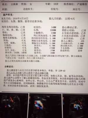 胎儿AF（胎儿af是什么意思）  第2张