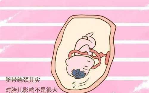 胎儿AF（胎儿af是什么意思）  第3张