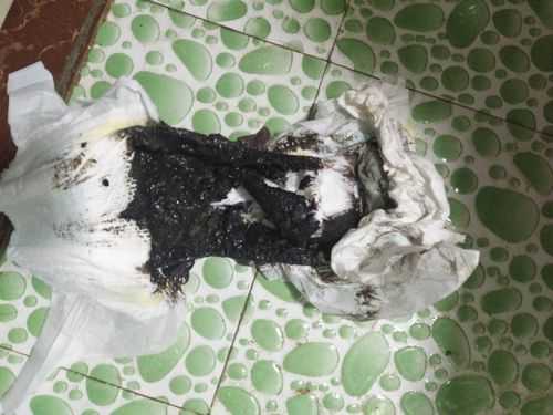 孕期拉黑屎(孕晚期贫血补铁大便怎么是黑色的,这是正常现象吗) 第1张 孕期拉黑屎(孕晚期贫血补铁大便怎么是黑色的,这是正常现象吗) 第1张