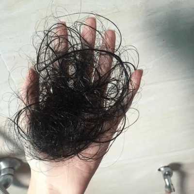 怀孕期间脱发(怀孕掉头发吗) 第2张 怀孕期间脱发(怀孕掉头发吗) 第2张