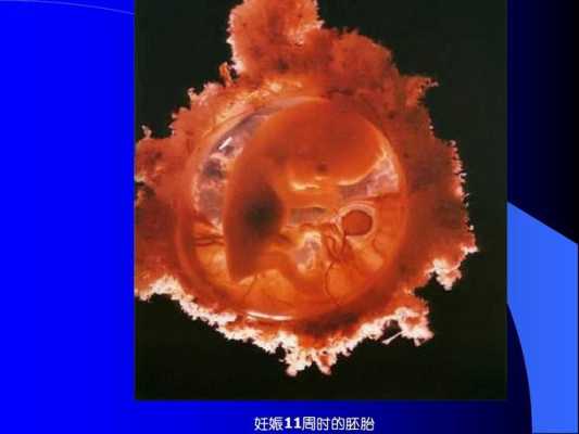 顽强的胎儿(顽强的胎儿说明什么) 第2张 顽强的胎儿(顽强的胎儿说明什么) 第2张