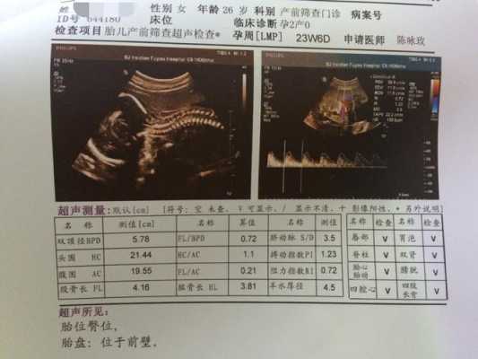 胎儿侧面图(侧面描写表现小孩的可爱) 第3张 胎儿侧面图(侧面描写表现小孩的可爱) 第3张