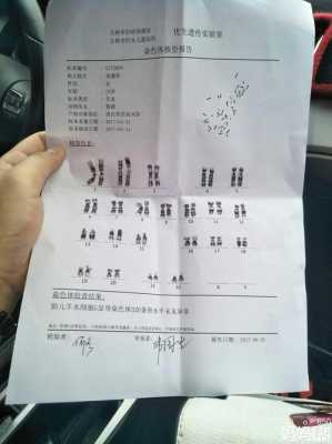 羊水穿刺检查核型分析和基因芯片的有什么不一样吗,胎儿基因芯片检查 第3张 羊水穿刺检查核型分析和基因芯片的有什么不一样吗,胎儿基因芯片检查 第3张