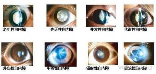 胎儿晶状体(托玛琳对孕妇有辐射吗) 第2张 胎儿晶状体(托玛琳对孕妇有辐射吗) 第2张
