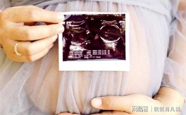 胎儿头在左边(胎儿头在左边还能左侧睡吗) 第2张 胎儿头在左边(胎儿头在左边还能左侧睡吗) 第2张