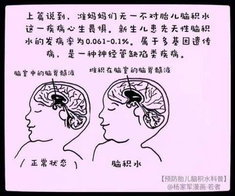 孕期胎儿脑积水的原因(孕期胎儿脑积水的原因) 第1张 孕期胎儿脑积水的原因(孕期胎儿脑积水的原因) 第1张