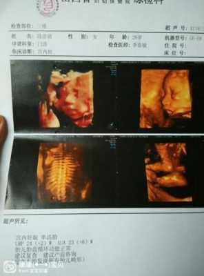 孕期三维彩超（三维彩超什么时候做）  第1张
