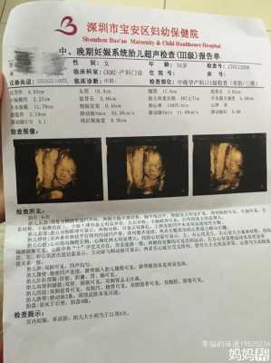 孕期三维彩超（三维彩超什么时候做）  第3张