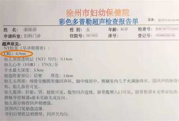 胎儿头围发育(怀孕3个月胎儿头臀长是多少) 第2张 胎儿头围发育(怀孕3个月胎儿头臀长是多少) 第2张