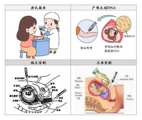 什么叫唐氏综合症,孕期综合症的表现怎么调节  第2张