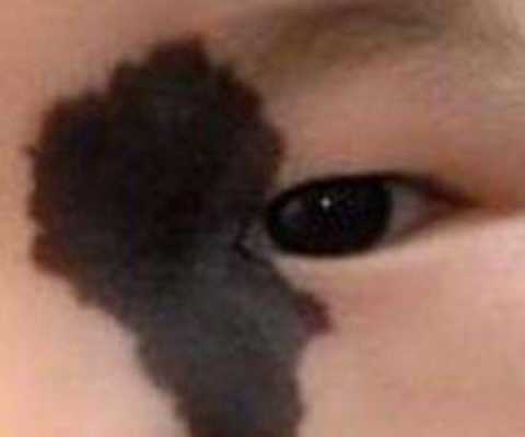 如何避免胎儿长胎记(刚出生的宝宝手背上有黑色胎记怎么消除) 第1张 如何避免胎儿长胎记(刚出生的宝宝手背上有黑色胎记怎么消除) 第1张