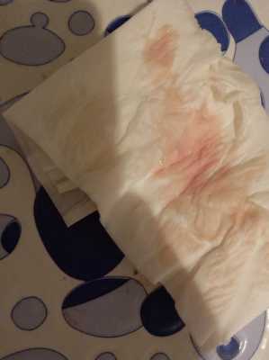 孕期见红了肚子不痛怎么办(孕妇见红了肚子不痛怎么办但是腰酸得不得了) 第1张 孕期见红了肚子不痛怎么办(孕妇见红了肚子不痛怎么办但是腰酸得不得了) 第1张