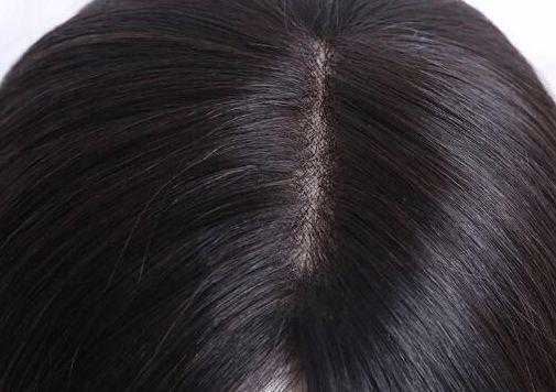 孕期白发(孕期白发增多是什么原因) 第2张 孕期白发(孕期白发增多是什么原因) 第2张