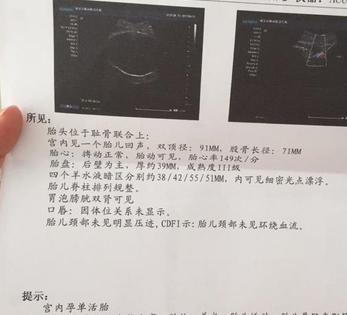 孕晚期胎儿偏小两周怎么办(孕36周b超偏小两周该怎么办,医生建议我多吃点东西,但是我真的没胃口啊) 第1张 孕晚期胎儿偏小两周怎么办(孕36周b超偏小两周该怎么办,医生建议我多吃点东西,但是我真的没胃口啊) 第1张