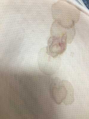 母乳刚开始出来怎么是透明的,孕期奶水透明是什么情况 第3张 母乳刚开始出来怎么是透明的,孕期奶水透明是什么情况 第3张