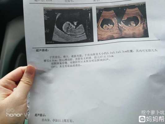 胎儿个子大(别人夸你孩子长得好高怎么回答) 第2张 胎儿个子大(别人夸你孩子长得好高怎么回答) 第2张