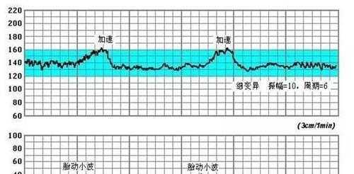 胎儿心跳加快(胎心快是什么原因) 第1张 胎儿心跳加快(胎心快是什么原因) 第1张