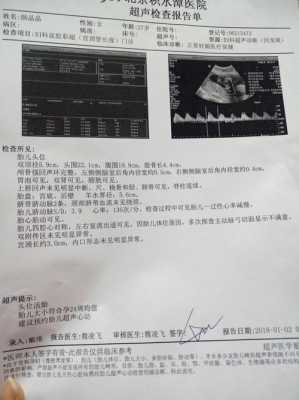 胎儿心跳加快(胎心快是什么原因) 第2张 胎儿心跳加快(胎心快是什么原因) 第2张