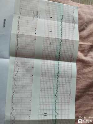 孕35周、胎动减少、胎心正常、这样正常吗,孕期胎动很少是宝宝懒吗  第2张