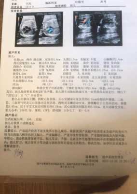 胎儿肌动脉(彩超pi和ri是什么意思) 第2张 胎儿肌动脉(彩超pi和ri是什么意思) 第2张