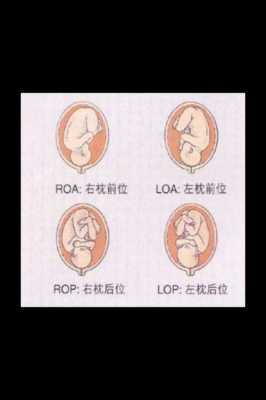 什么是loa胎位,胎儿loa胎位图片 第1张 什么是loa胎位,胎儿loa胎位图片 第1张