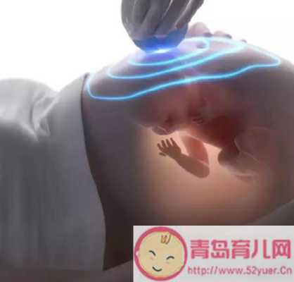 胎儿趴着怎么办(做nt胎儿趴着怎么办) 第2张 胎儿趴着怎么办(做nt胎儿趴着怎么办) 第2张