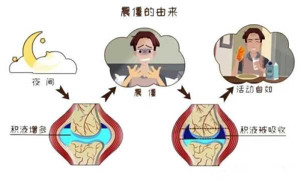 孕期关节响(身体关节响怎么回事) 第1张 孕期关节响(身体关节响怎么回事) 第1张