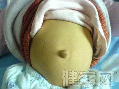 胎儿胆道闭锁孕妇症状(胎儿胆道闭锁孕妇症状有哪些) 第1张 胎儿胆道闭锁孕妇症状(胎儿胆道闭锁孕妇症状有哪些) 第1张