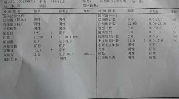 孕期验尿单（孕妇验尿单）  第3张