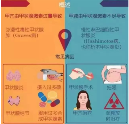 孕妇甲亢对胎儿有哪些影响,孕期甲亢严重还是甲减严重 第2张 孕妇甲亢对胎儿有哪些影响,孕期甲亢严重还是甲减严重 第2张