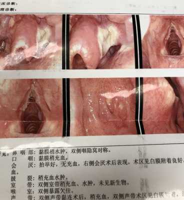 孕期阴道囊肿(孕期有囊肿怎么办) 第1张 孕期阴道囊肿(孕期有囊肿怎么办) 第1张
