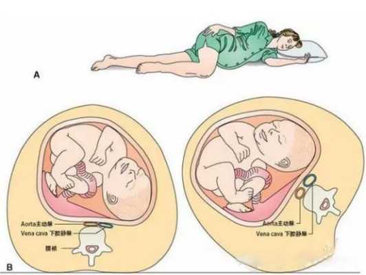 怀孕肚子歪右边怎么回事,怀孕肚子歪右边注意事项,孕期子宫右旋是什么意思 第1张 怀孕肚子歪右边怎么回事,怀孕肚子歪右边注意事项,孕期子宫右旋是什么意思 第1张