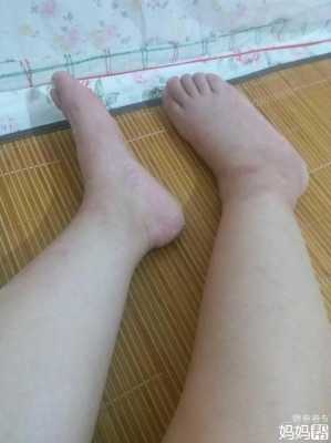 孕妇脚酸,孕期眼酸是怎么回事 第1张 孕妇脚酸,孕期眼酸是怎么回事 第1张