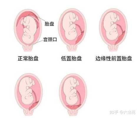 孕妇血压低对胎儿发育有影响吗,胎盘低会影响胎儿发育吗知乎  第2张