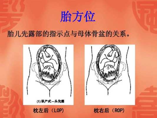 什么叫左枕,胎儿左枕后位是什么意思啊 第3张 什么叫左枕,胎儿左枕后位是什么意思啊 第3张