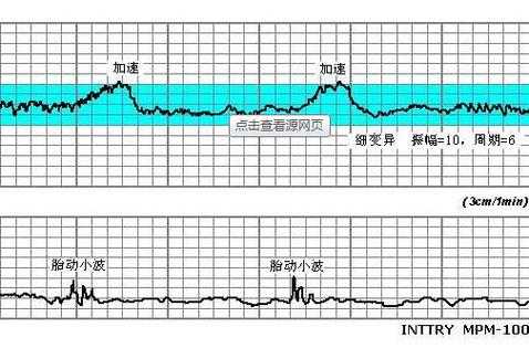 怀孕三个月胎儿有多大图片(胎心率167正常吗?怀孕三个月,胎心一般是多少) 第1张 怀孕三个月胎儿有多大图片(胎心率167正常吗?怀孕三个月,胎心一般是多少) 第1张