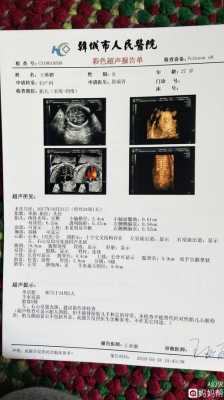 胎儿光片(胎儿光斑什么意思) 第1张 胎儿光片(胎儿光斑什么意思) 第1张