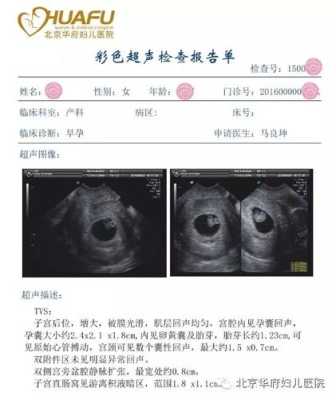 胎儿没胎心是什么原因,是什么原因导致的呢,胎儿无心跳是什么原因导致的 第2张 胎儿没胎心是什么原因,是什么原因导致的呢,胎儿无心跳是什么原因导致的 第2张